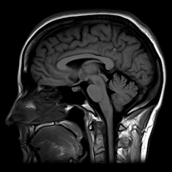 Scope Radiology brain